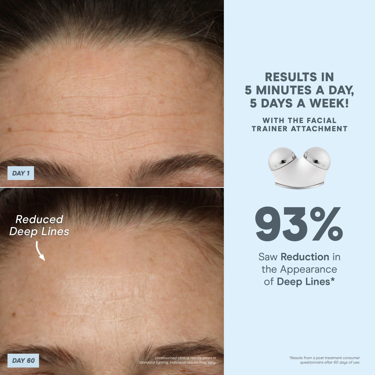 TRINITY+ Complete Set - Smart Microcurrent + LED Red Light Facial Toning Kit