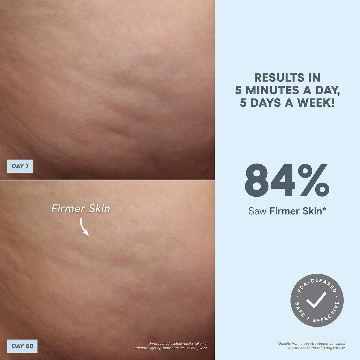 NuBODY® - Microcurrent Skin Toning Device for Body